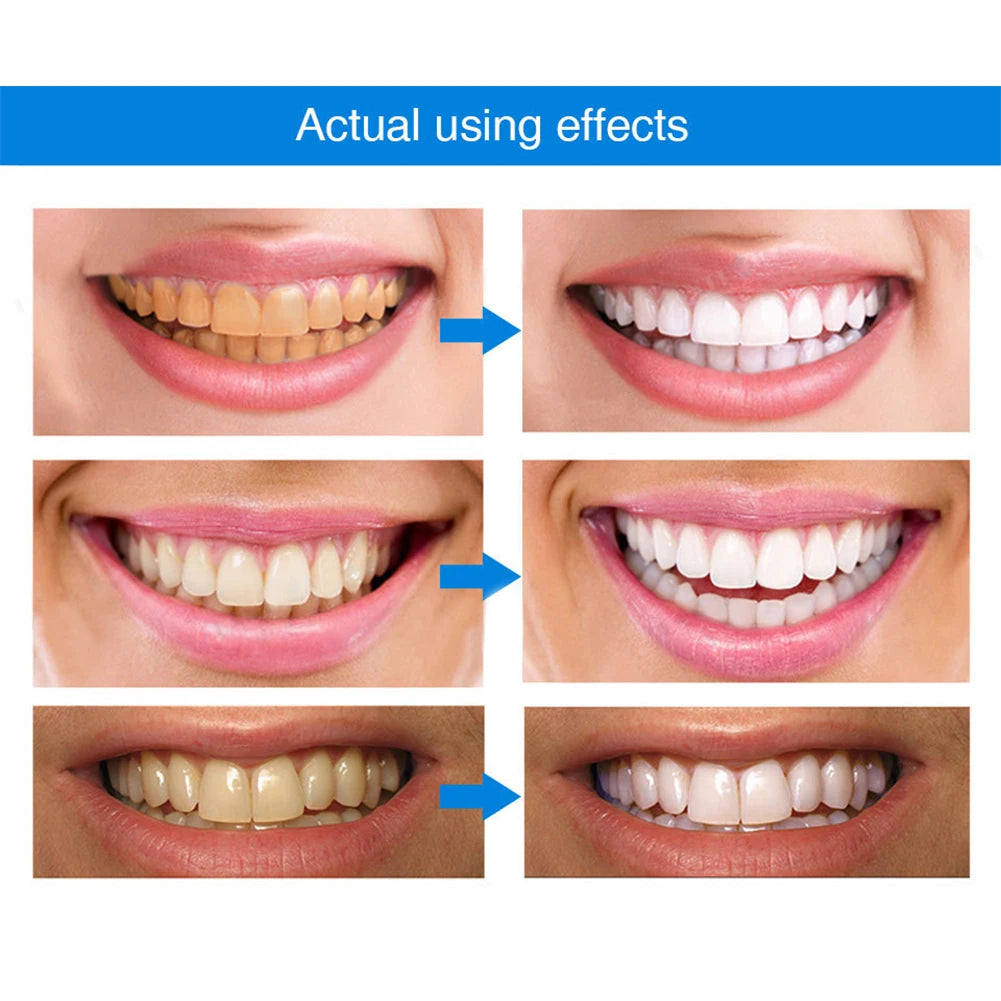 Lant-Home Teeth Whitening Essence